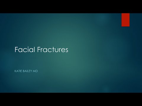 Facial fractures