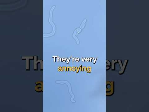 What are Eye Floaters and why do you see them?