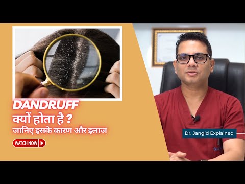 Why does dandruff occur? Learn about its causes and treatment Dr Jangid | SkinQure