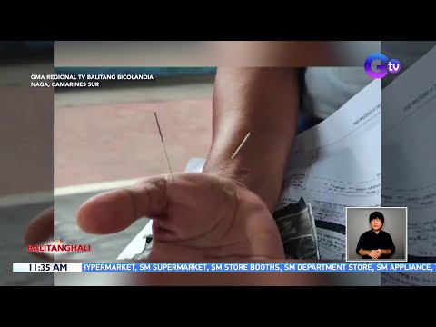 Nasa 100 residente, nabigyan ng libreng acupuncture treatment BT