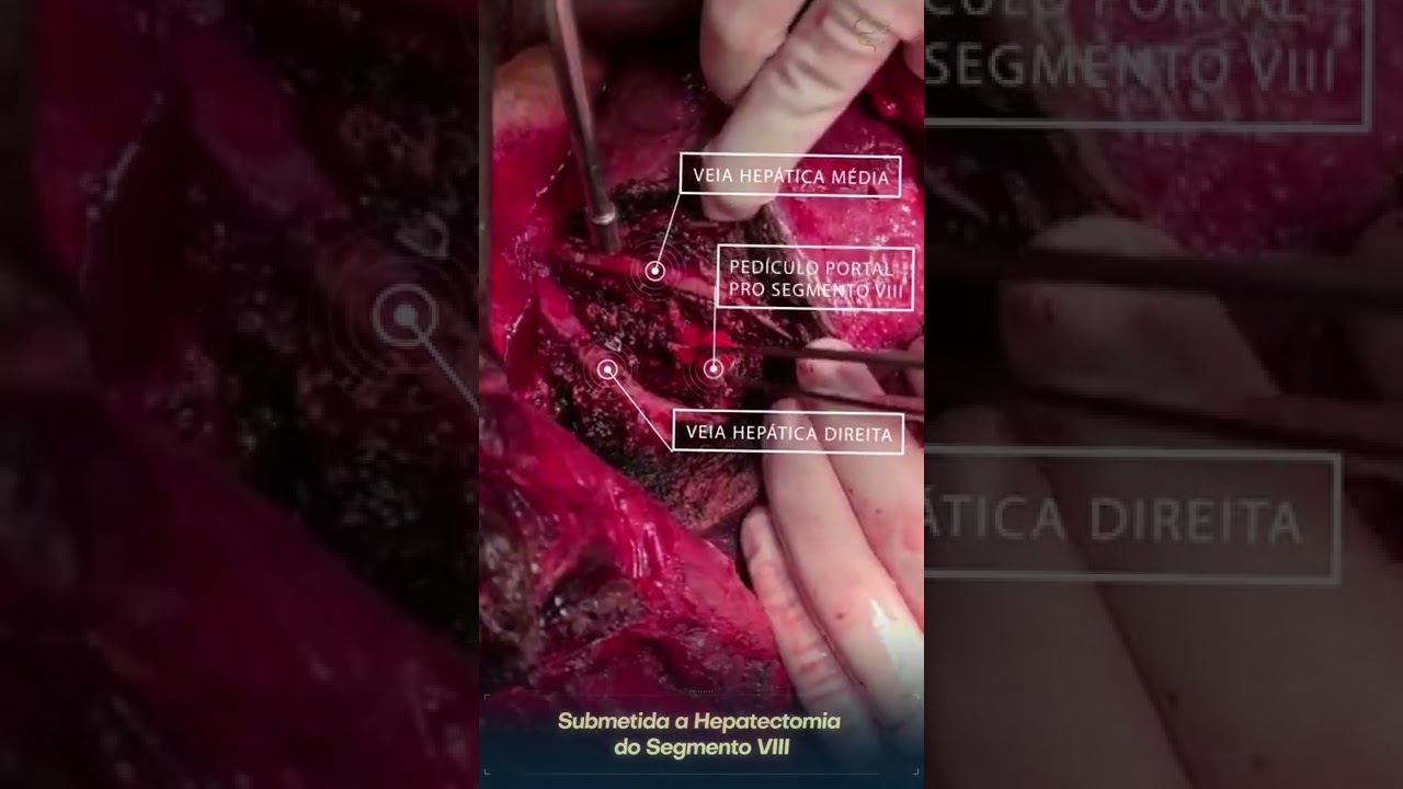 Pablo Duarte Rodrigues-15