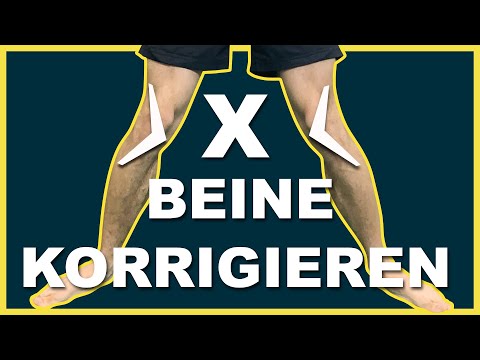 X-BEINE wegtrainieren & korrigieren - mit diesen 7 Übungen!