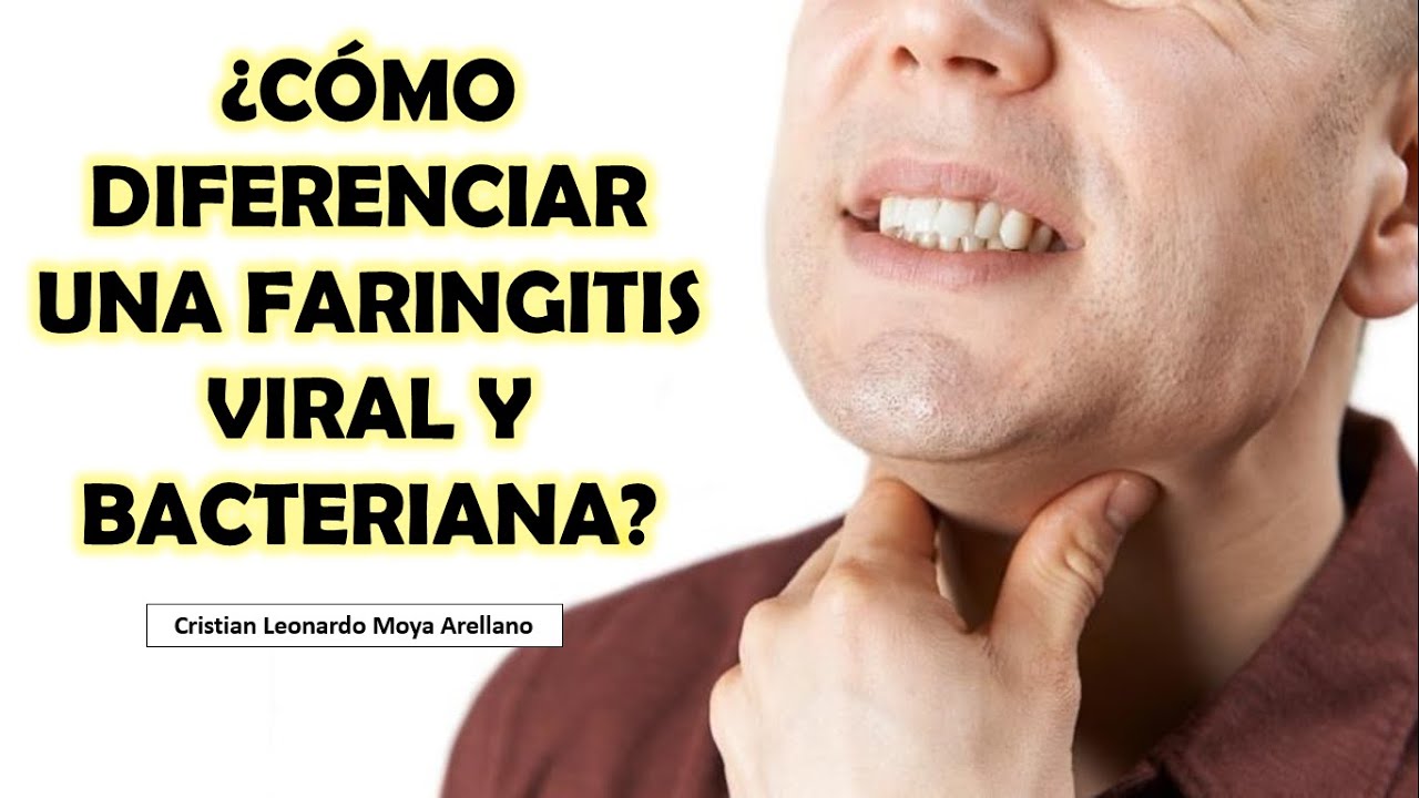 🔴 ¿CÓMO DIFERENCIAR UNA FARINGITIS VIRAL Y BACTERIANA?