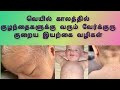 Baby Verkuru Poga Tips In Tamil Prickly Heat Home Remedy In Tamil Baby Care Tips Baby Heat Rash
