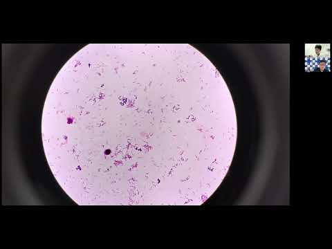 看護学科 尿でグラム陽性桿菌？これって嫌気性菌？