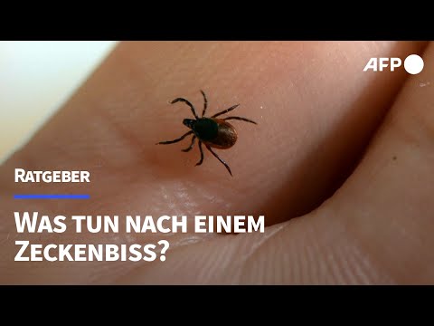 Zecken: So schützt man sich | AFP