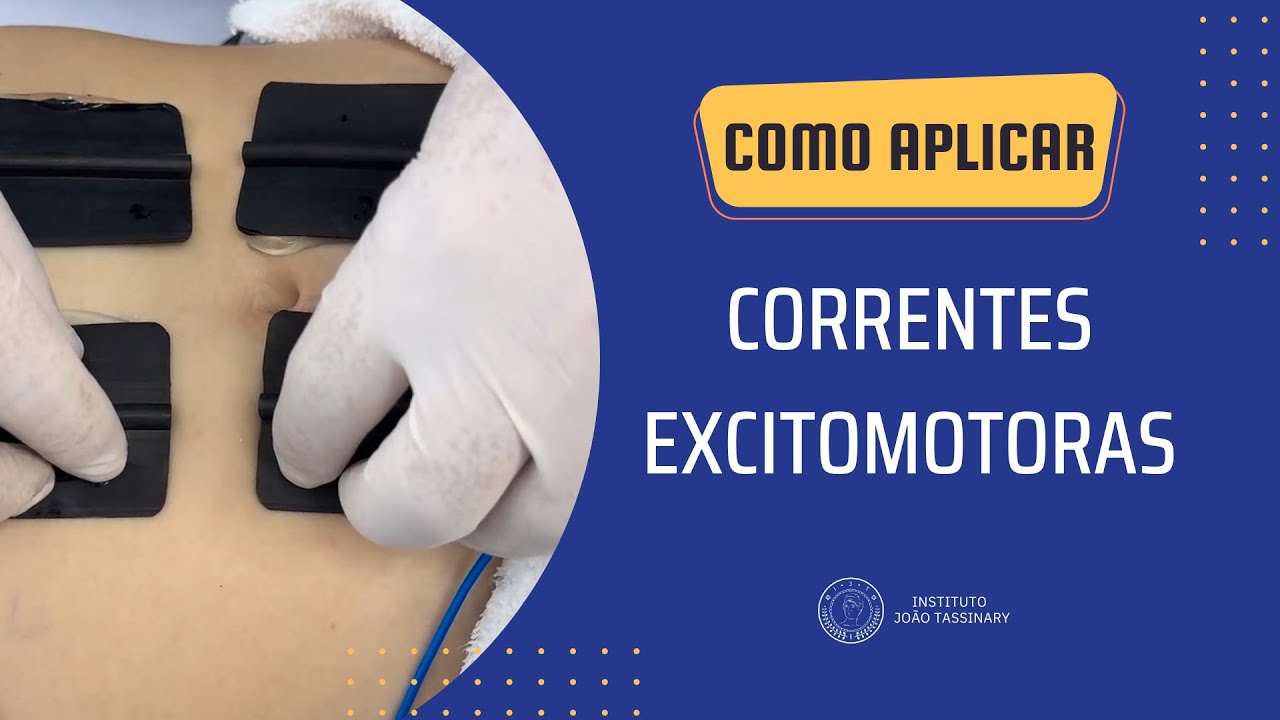COMO APLICAR CORRENTE RUSSA OU AUSSIE | DR. JOÃO TASSINARY