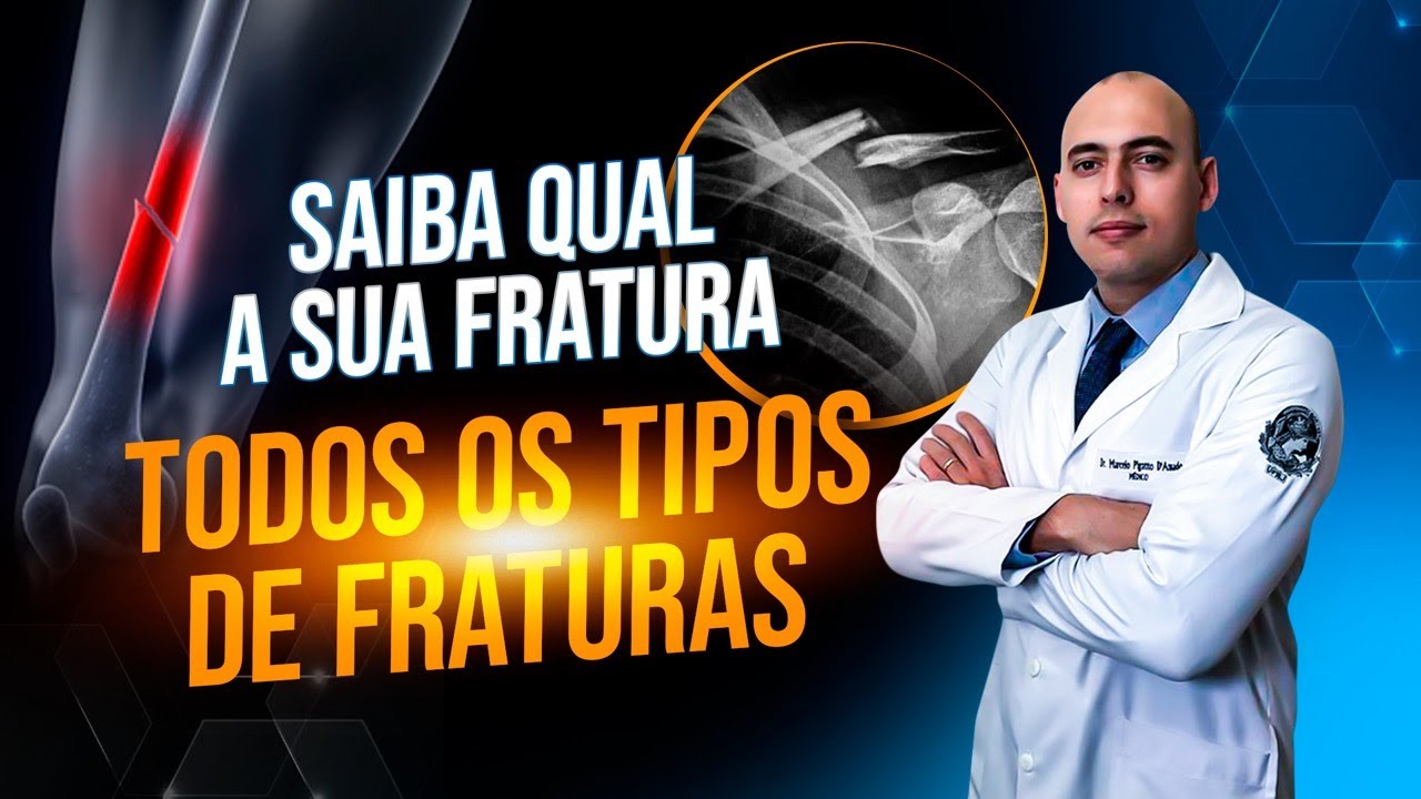 TIPOS DE FRATURA | SAIBA QUAL É A SUA FRATURA!