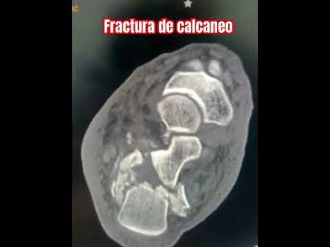 Carlos Tapia Hernández-19