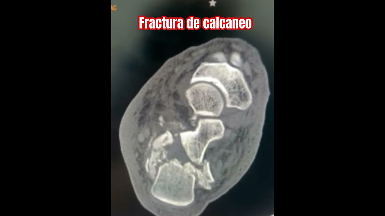 Carlos Tapia Hernández-19