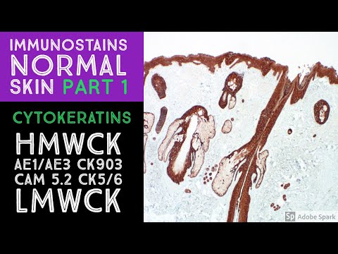 Immunohistochemistry in Normal Skin: Cytokeratins