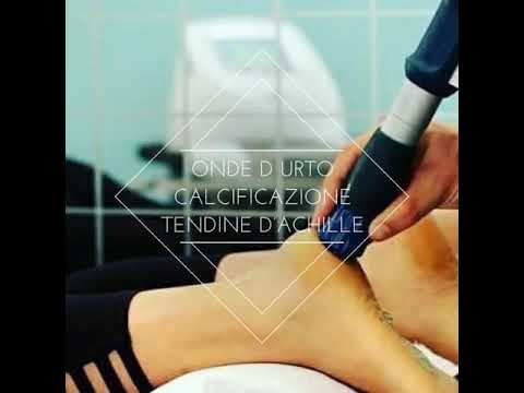 Onde D’Urto al Tendine D’Achille