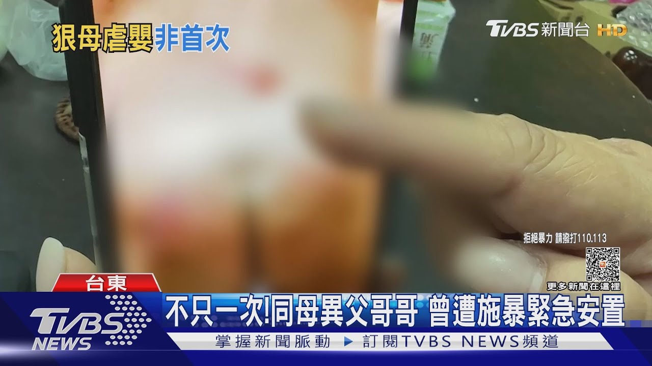 不只一次!同母異父哥哥 曾遭施暴緊急安置