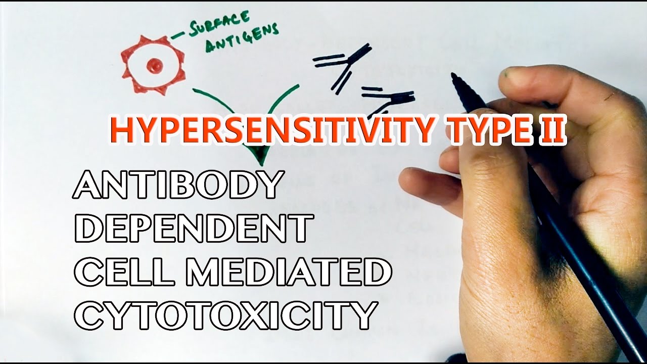 Antibody Dependent Cell Mediated Cytotoxicity or Hypersensitivity Type II