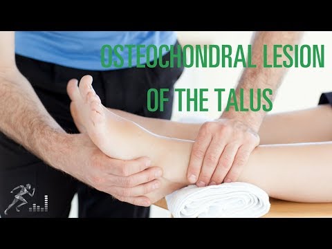 Osteochondral lesion of the talus (OCD lesion): Signs, symptoms and treatment options