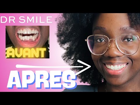 I tested Dr Smile for 300 days (My honest opinion)