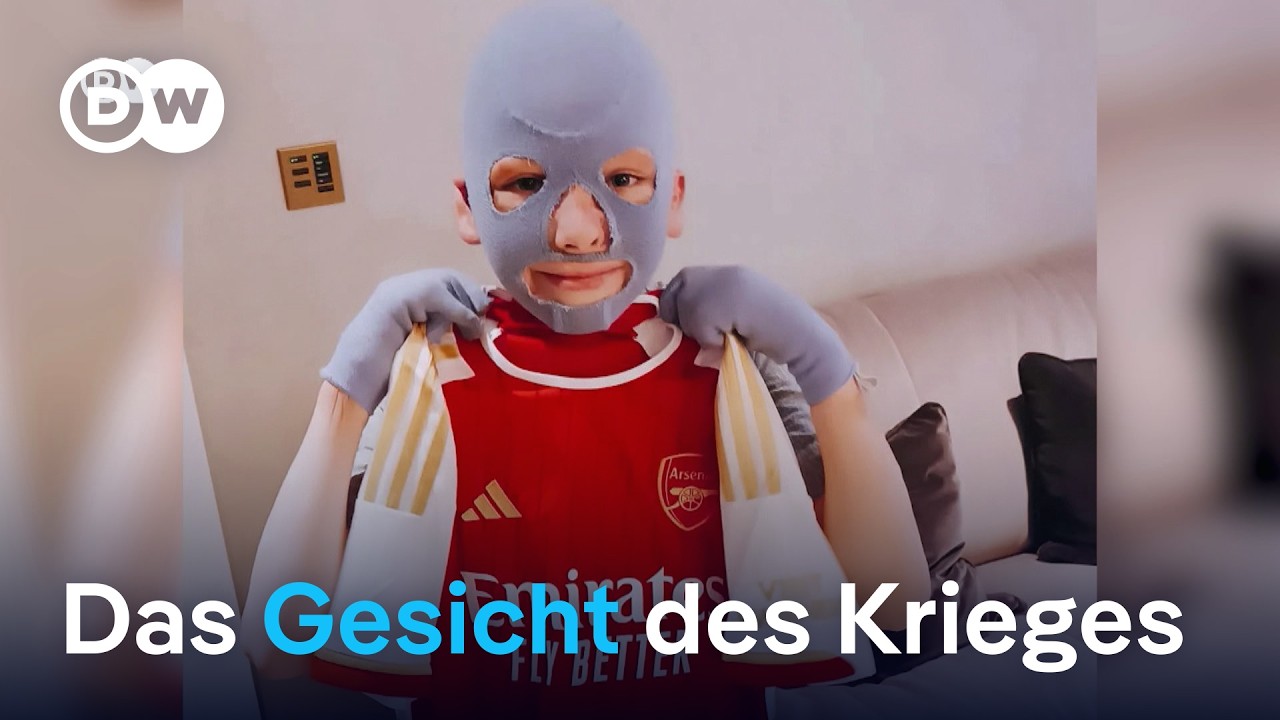 Ein 11jähriger verwundeter Ukrainer wirbt in den USA für sein Land | DW Nachrichten