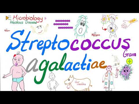 Streptococcus agalactiae (Group B Strept or GBS)...Neonatal Meningitis, sepsis, pneumonia