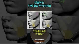 압구정성형외과) 얼굴 이중턱지방흡입부위는 어디? 시술 후 흉터도 남을까?