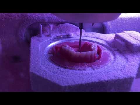 Merz Dental Baltic Denture BDLoad Milling Technologie Part3