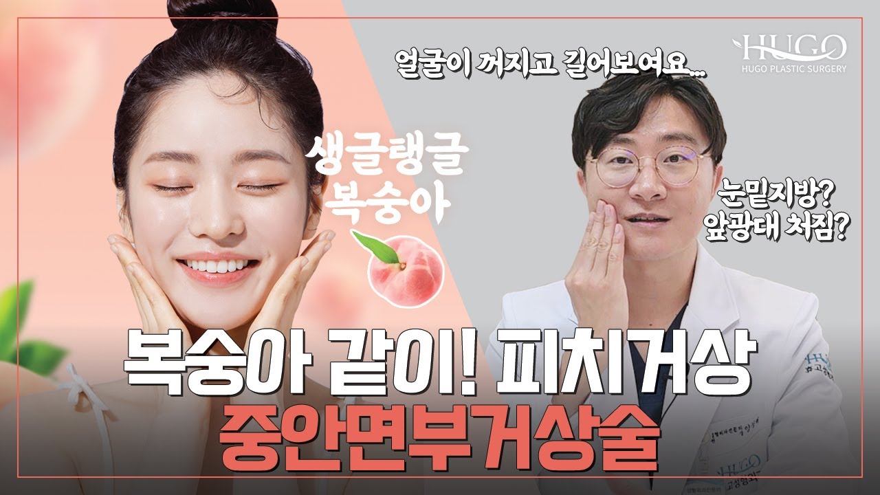 눈밑지방과 앞광대 처짐을 위한 하안검+피치거상술!