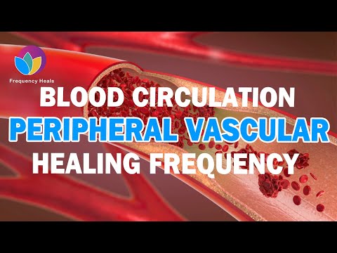 Peripheral Vascular Disease Healing Frequency ➤ Let the Blood Flow Freely Inside You