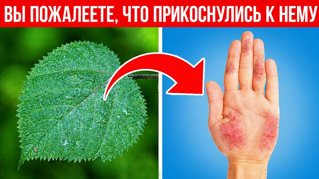 Это растение обжигает так, что боль не проходит годами — вы бы не рискнули к ?