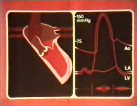 Blutdruckregulierungsindikatoren 2 Hypertension soweit diese
