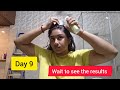 Rosemary Water For Hair Growth 15 Days Challenge Real Results Review