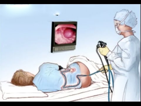 Vitamine für Prostata-Männer SSB und Prostata Ultraschall
