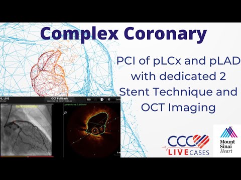 PCI of pLCx and pLAD with dedicated 2 Stent Technique and OCT Imaging - September 18, 2018