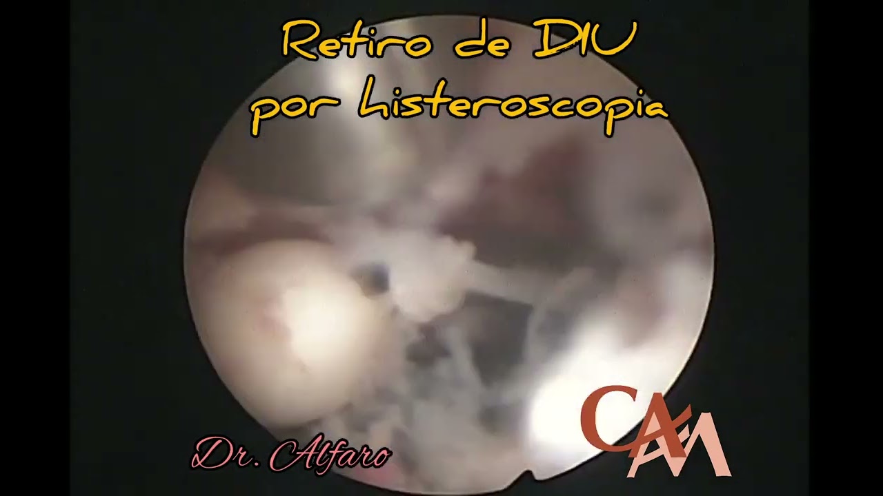 Carlos Alberto Alfaro Miranda-6