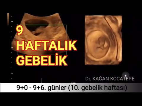 2 aylık (9 haftalık) gebelik - 10. haftada bebek ultrasonda nasıl görünür?