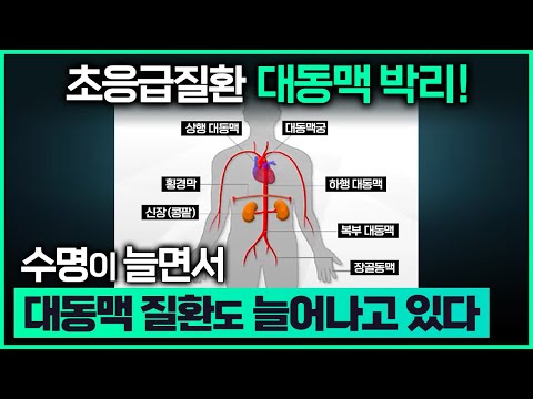 영상 썸네일