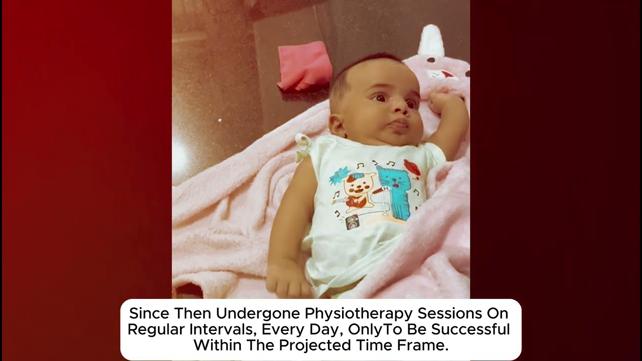 Infant born with Erb's Palsy condition.