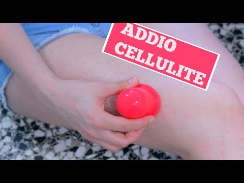 Il perossido didrogeno per candeggiare posti di pigmentary Decolorazione laser di prezzo di lentiggini