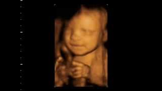 3D 4D Ultrasound baby scan. Window to the Womb Ltd