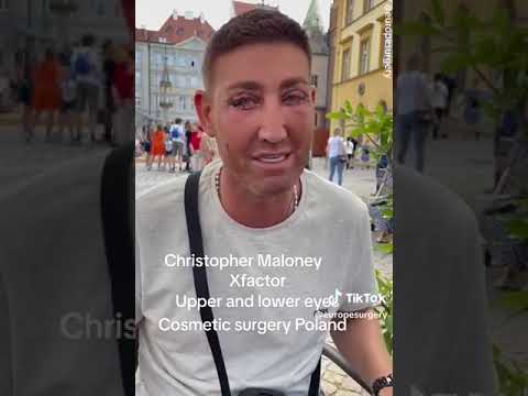 Christopher Maloney shocks with bruised eyes following surgery