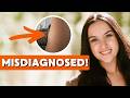 Doctors Thought It Was A Benign Lipoma It Was Rare Cancer I Thought It Was A Muscle Injury