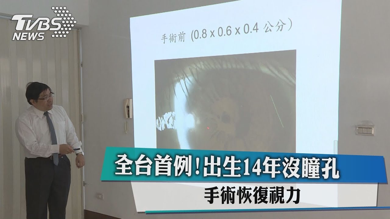全台首例!出生14年沒瞳孔 手術恢復視力