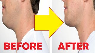 how to get rid of excess skin under chin after weight loss