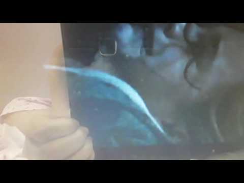 Emma Watson crying like a freak episode2