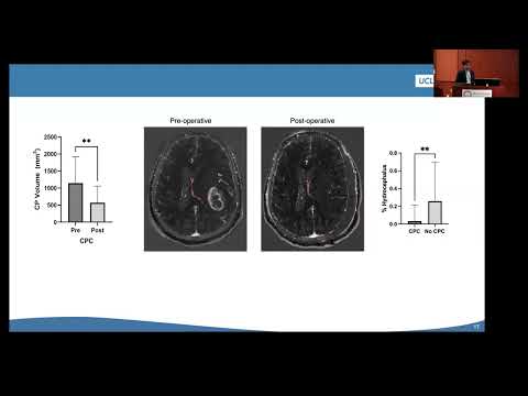 BRI Joint Seminar in Neuroscience - Kunal Patel, M.D. & John Sakon, Ph.D.