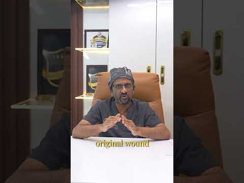 Keloid Scar Treatment Explained | Causes, Symptoms & Medical Solutions | Cosmo Radiance Hyderabad