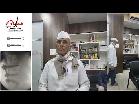 Spinal Fusion Treats TB Spine with Leg Weakness | Dr. Sachin Patil