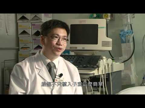 植入胎盤