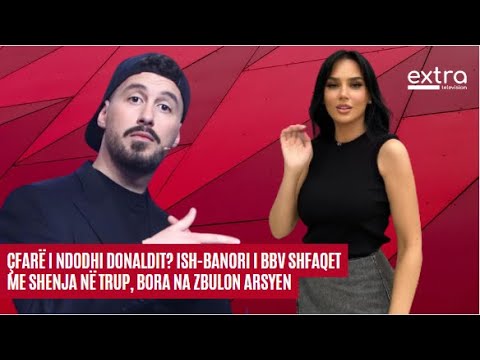Çfarë i ndodhi Donaldit? Ish-banori i BBV shfaqet me shenja në trup, Bora na zbulon arsyen - 2023