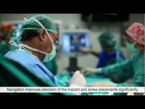 Brainlab CT-Fluoro Image Fusion Enables Minimally Invasive Spine Surgery