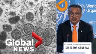WHO director calls for increased testing, more access to vaccines to combat monkeypox | FULL