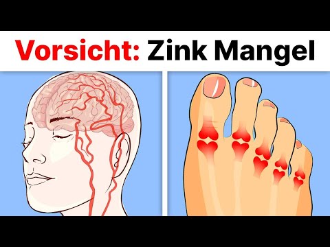 5 alarmierende Anzeichen, dass du unter einem Zink-Mangel leidest!